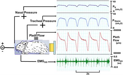 A Novel Non-invasive Approach for Measuring Upper Airway Collapsibility in Mice